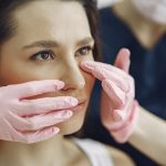 Frequently Asked Questions in Rhinoplasty